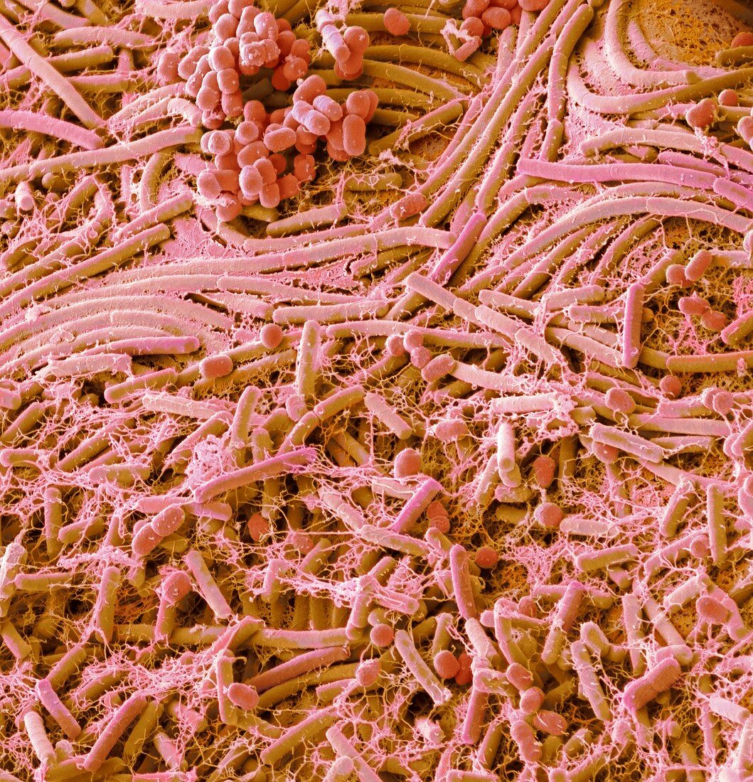 Bacteria from a one pound coin, SEM