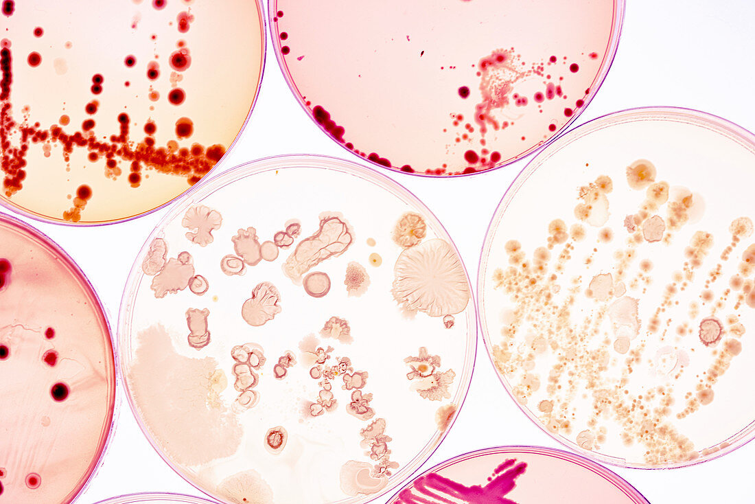 Bacterial colonies on agar plates