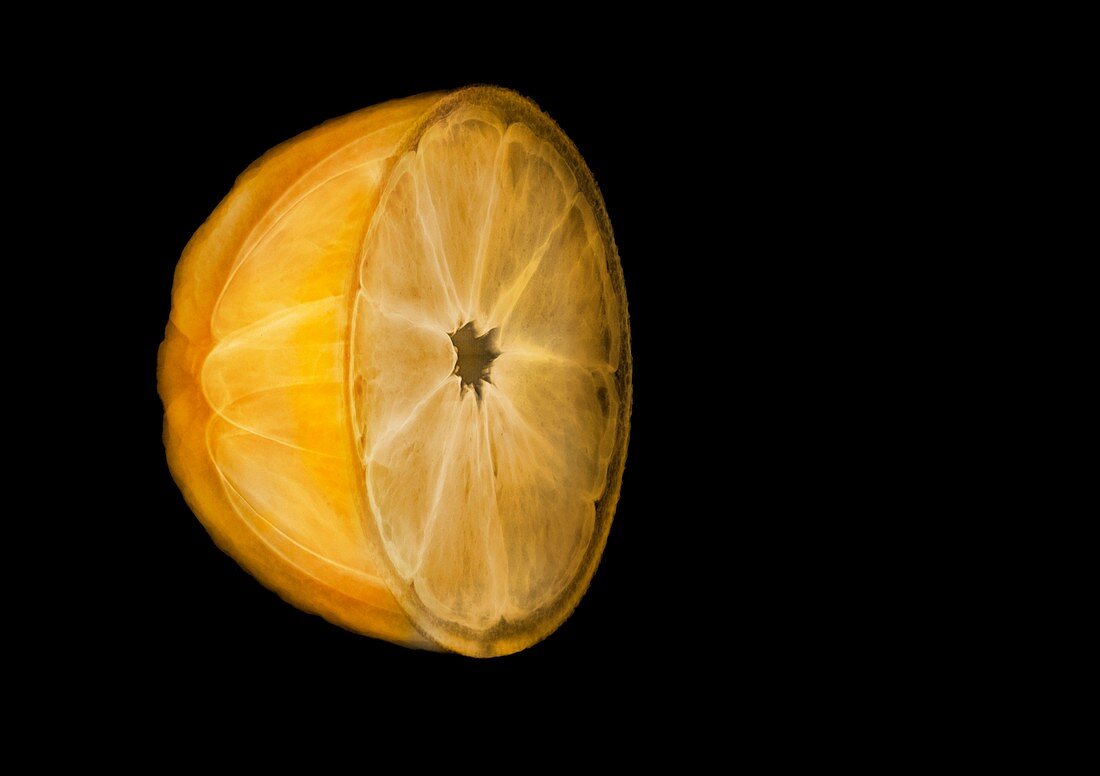 Half an orange showing segments, X-ray