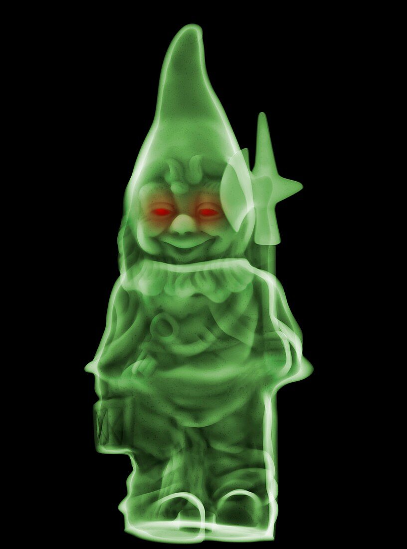 Garden gnome, X-ray