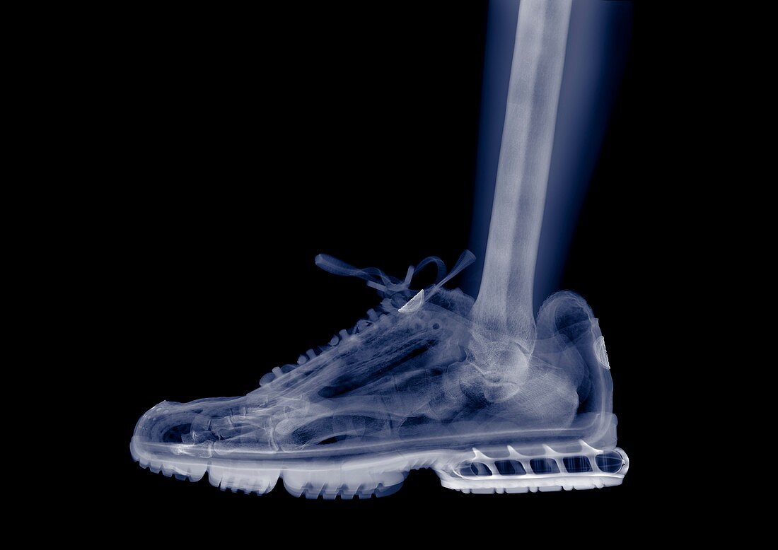 Foot and ankle in a running shoe, X-ray