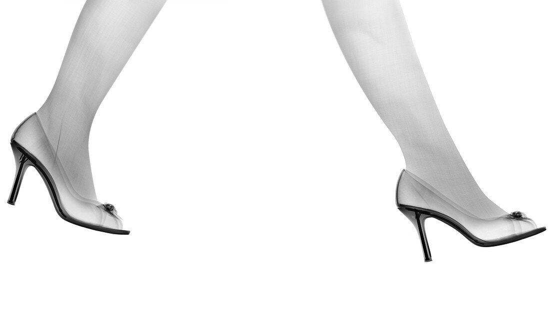 High heels walking, X-ray