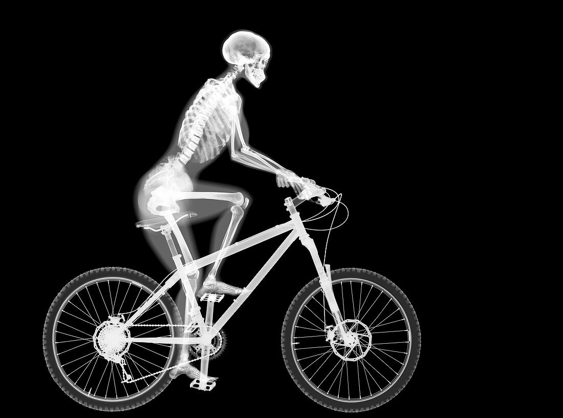 Skeleton and mountain bike, X-ray