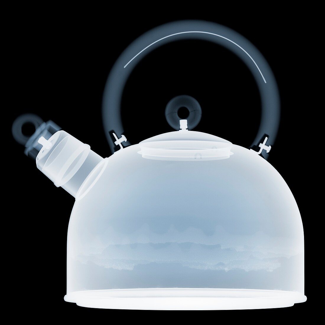 Kettle, X-ray