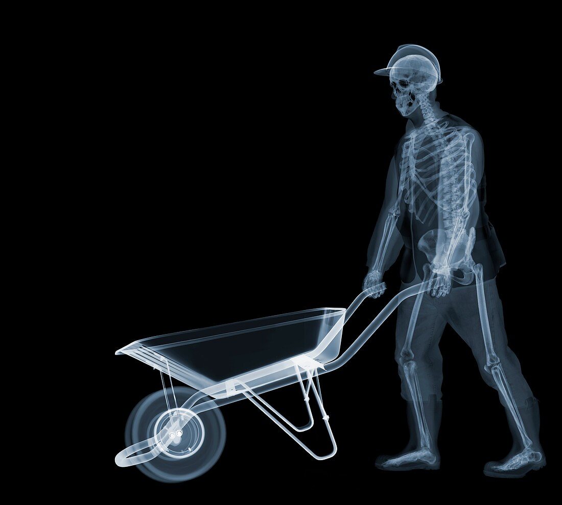 Workman with wheelbarrow, X-ray