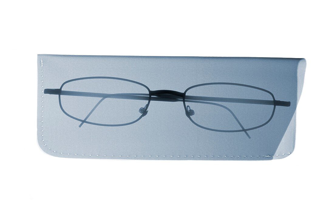 Glasses in case, X-ray