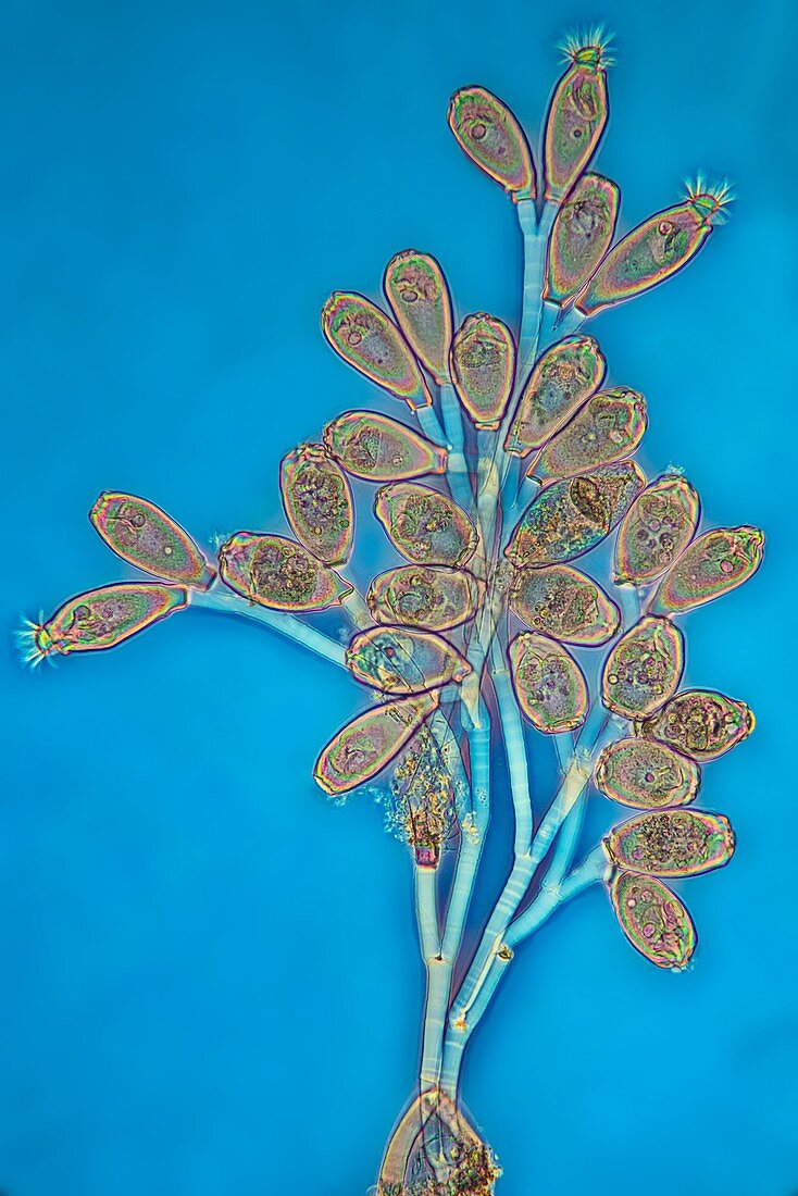 Opercularia peritrich ciliate, light micrograph