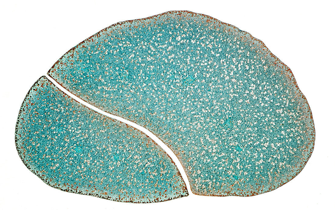 Loquat tree fruit cross-section, light micrograph