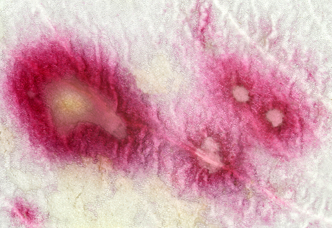 Botrytis blight on rose petal, light micrograph