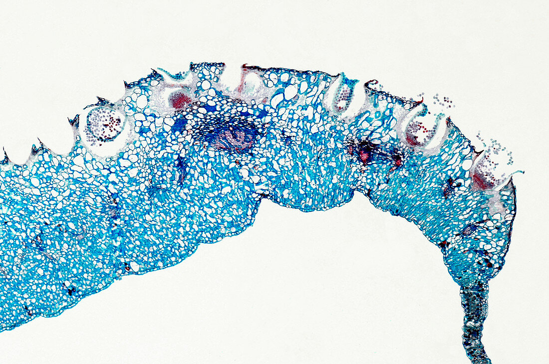 Wheat rust showing aecia, light micrograph