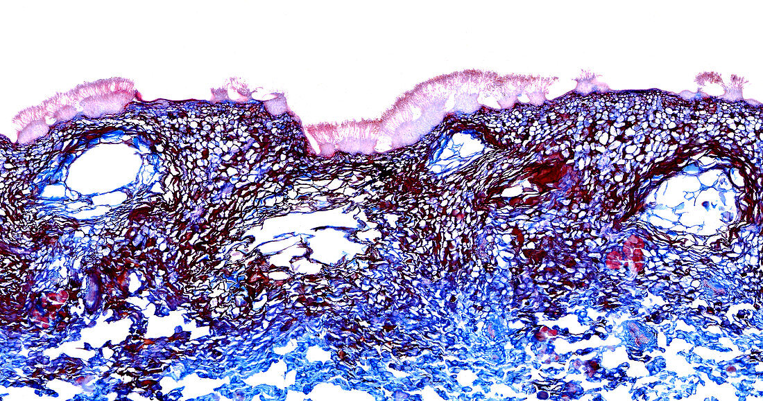 Penicillium mycelium and conidiophores, light micrograph