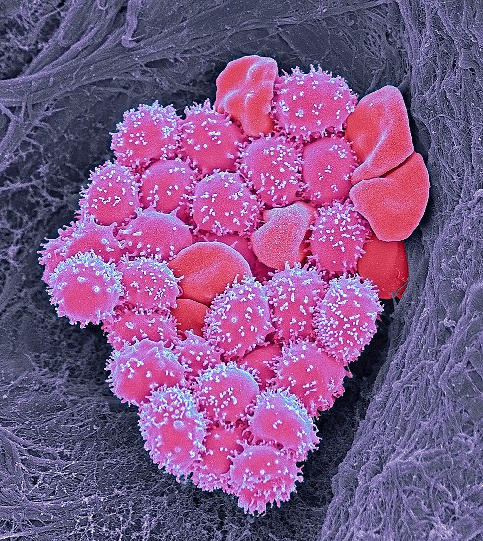 Crenate red blood cells, SEM