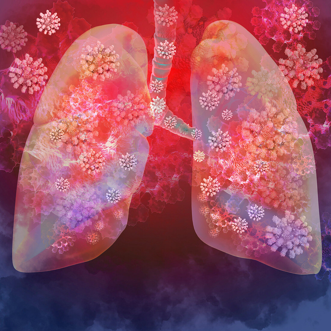 Covid-19 infection, conceptual illustration