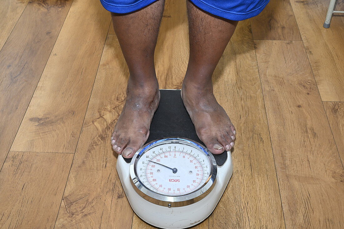 Man being weighed