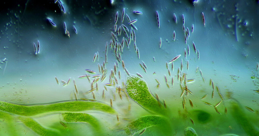 Ophrydium protozoa and diatoms, light micrograph