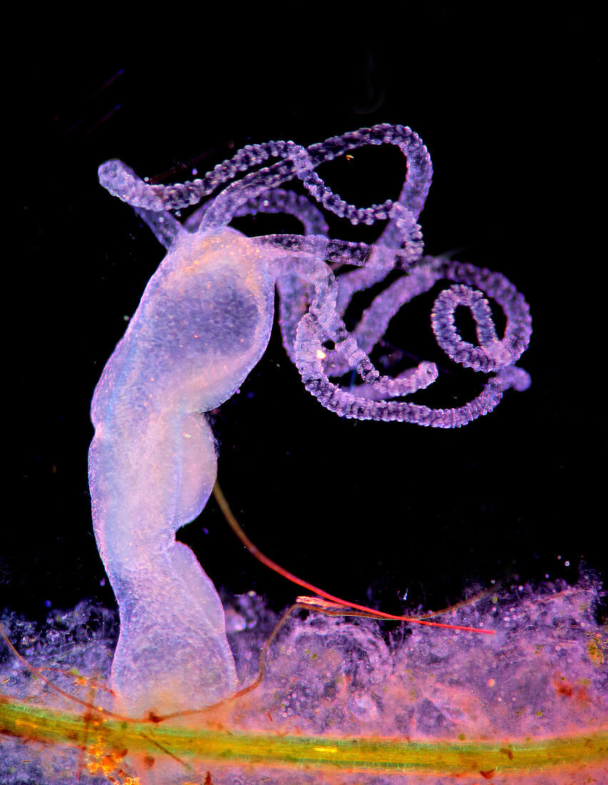 Hydra, polarised light micrograph