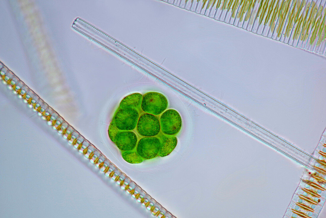 Pandorina green algae and diatoms, light micrograph