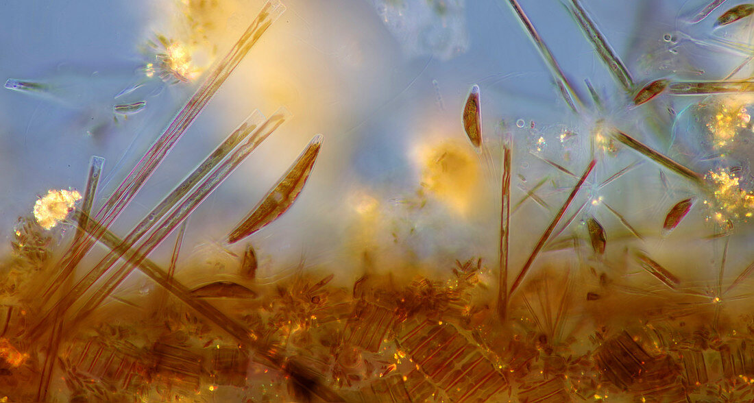 Diatoms, polarised light micrograph