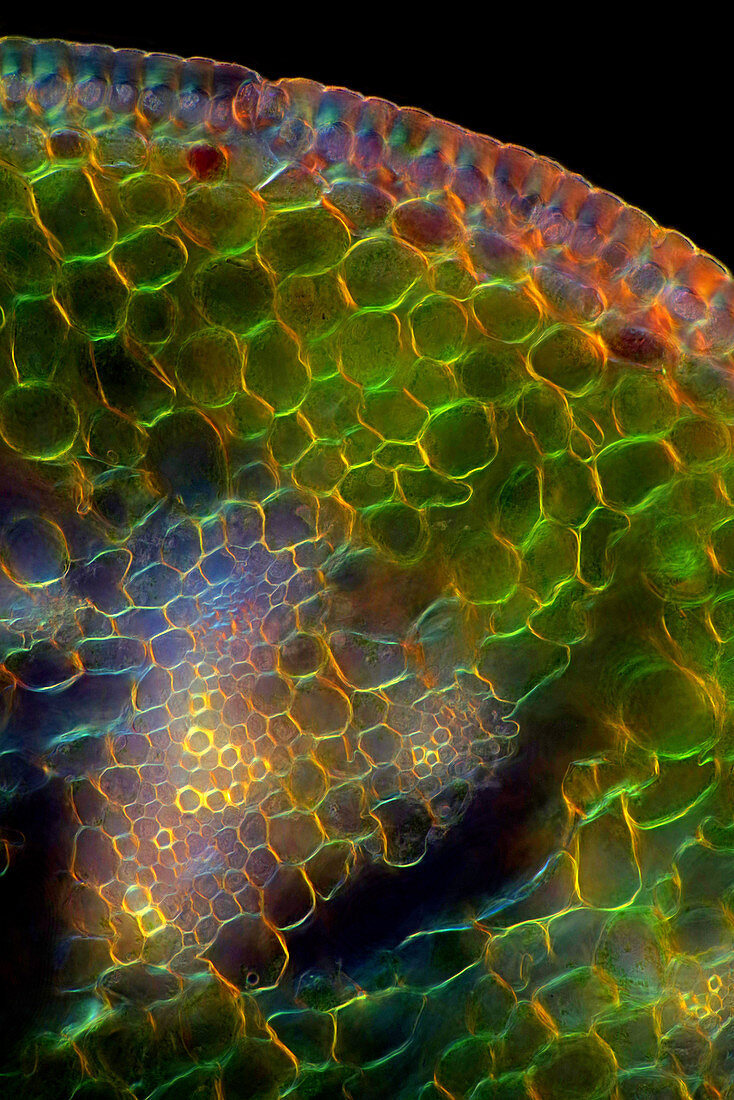 Tulip leaf, light micrograph