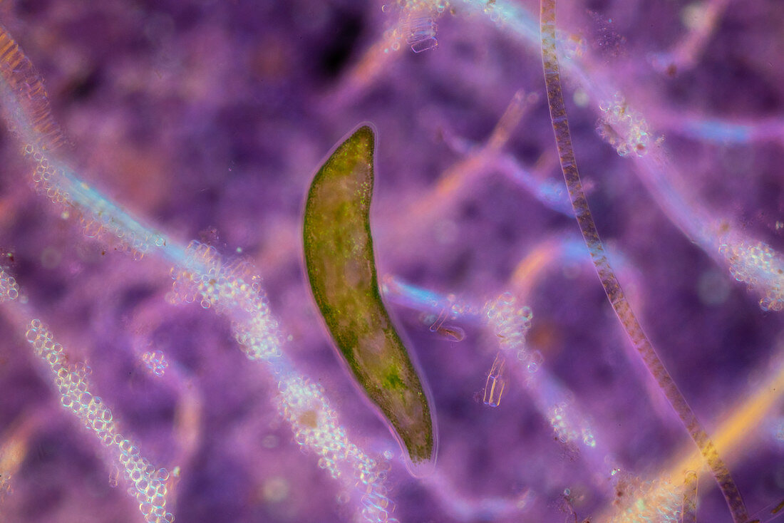 Flatworm, polarised light micrograph