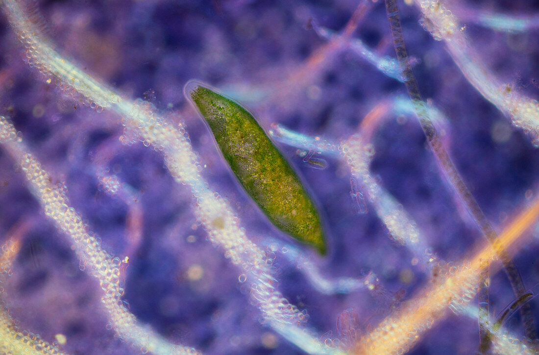 Flatworm, polarised light micrograph