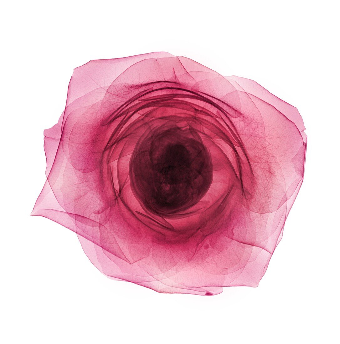 Pink rose head (Rosa centifolia), X-ray