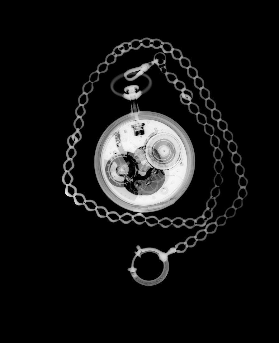 Pocket watch and chain, X-ray