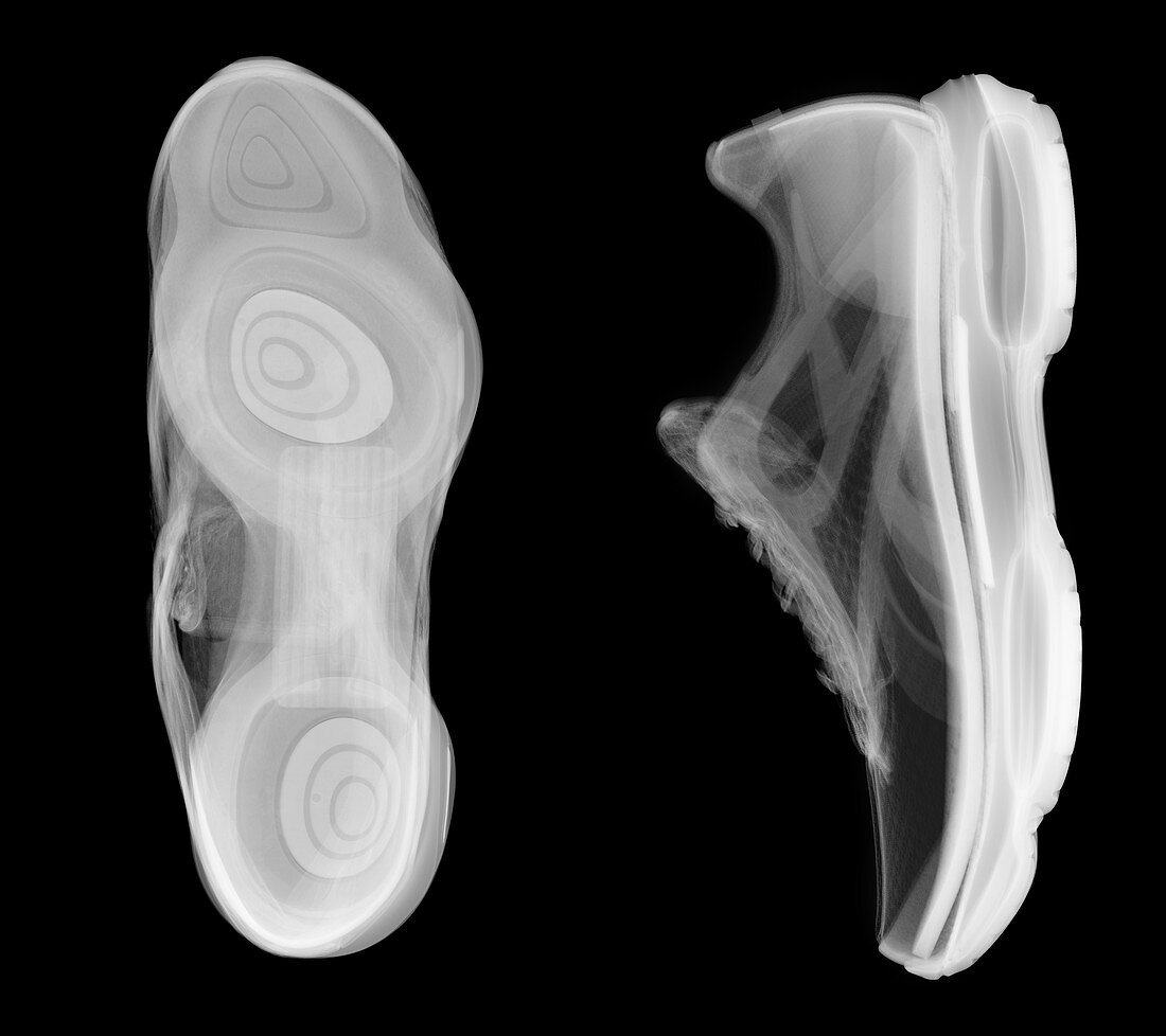 Running shoes, X-ray