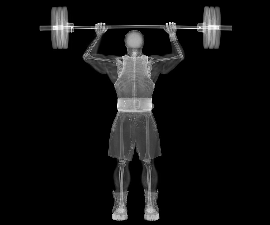 Weightlifter bodybuilder skeleton, X-ray