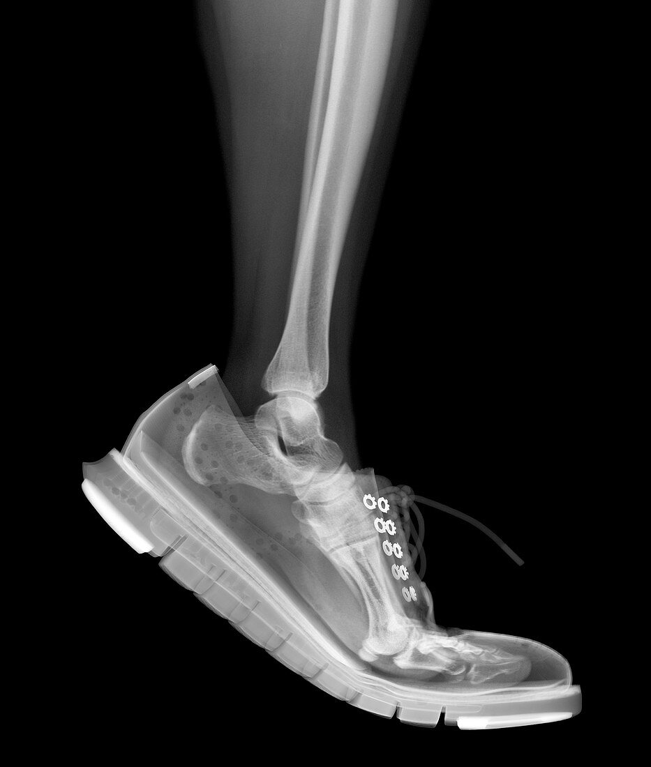 Skeleton lower leg in brogue, X-ray