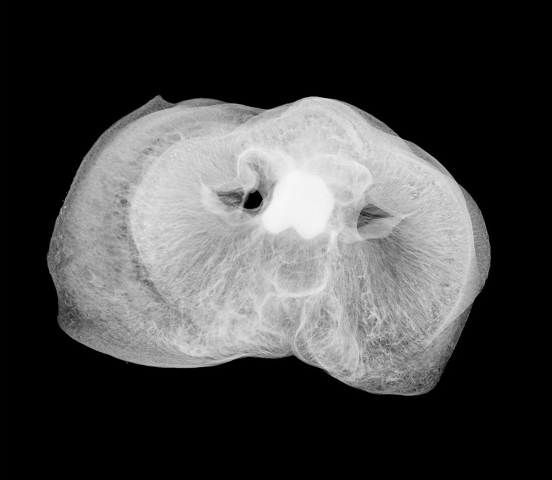Pig's snout, X-ray