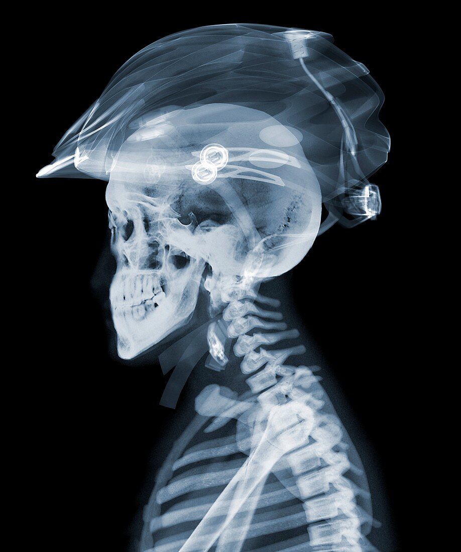 Rider with cycle helmet, X-ray