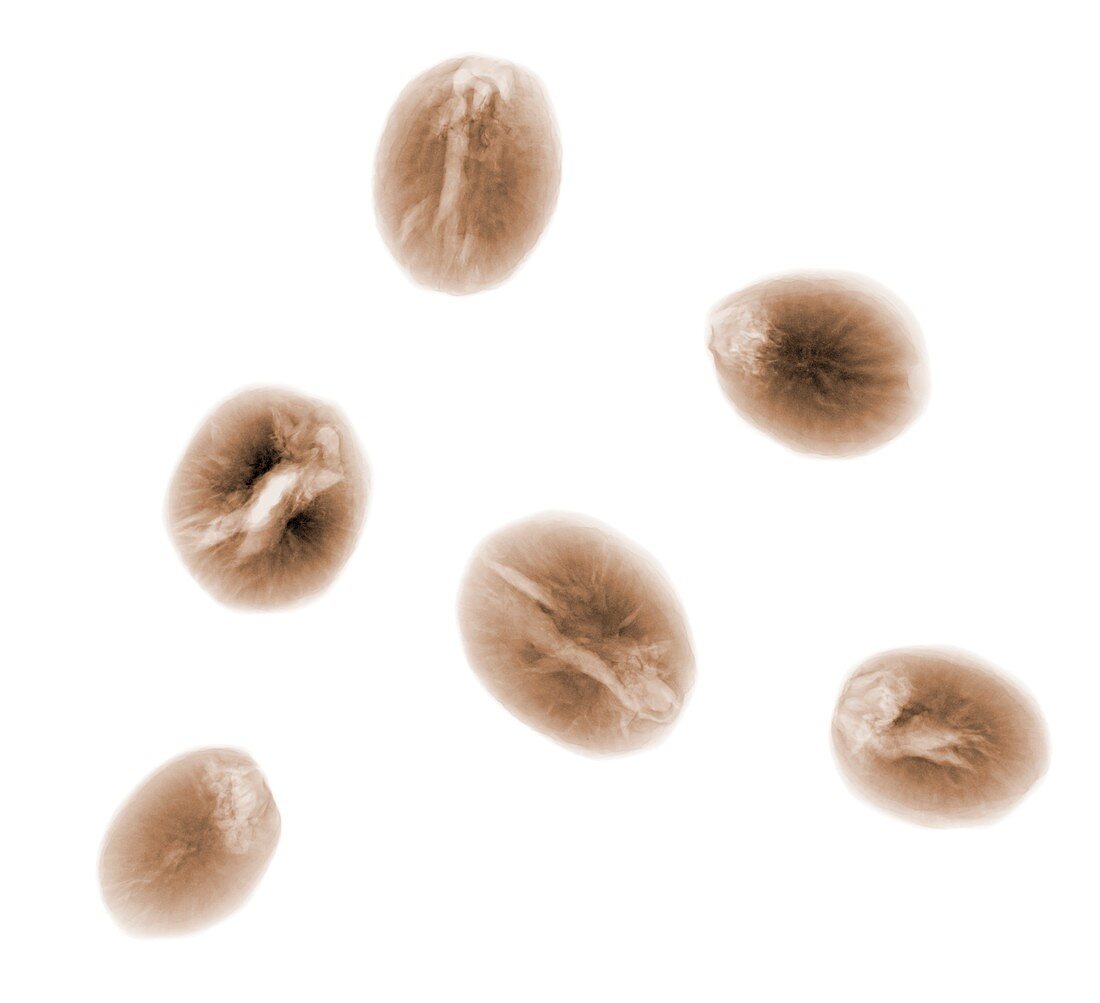 Nutmeg (Myristica fragrans), X-ray