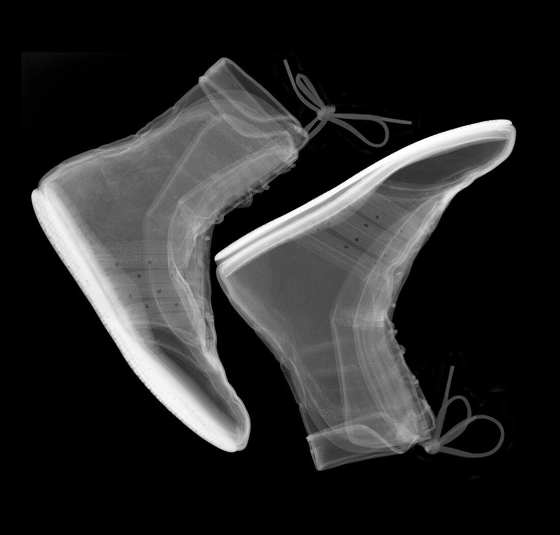 Boxing boots, X-ray