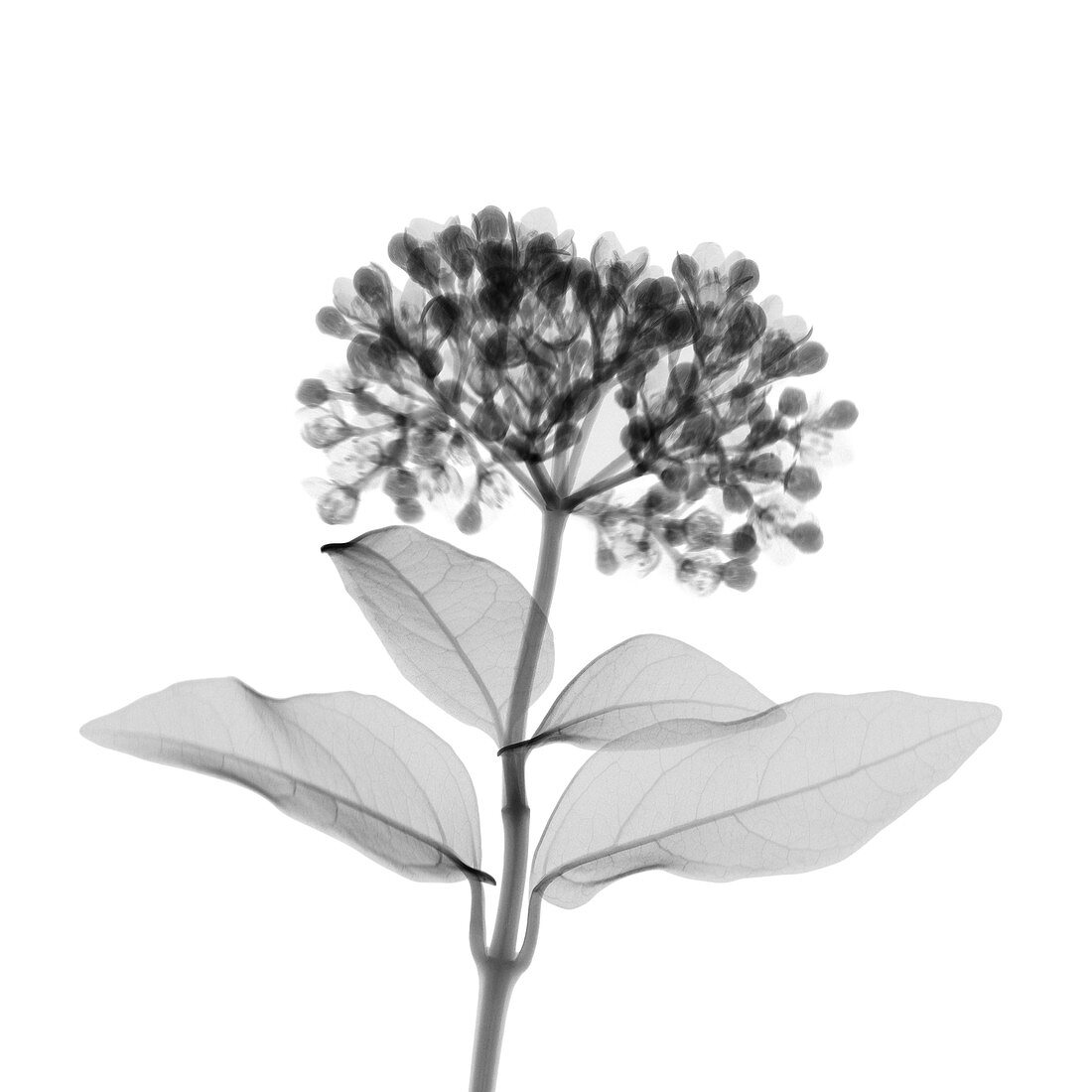 Elderberry, X-ray