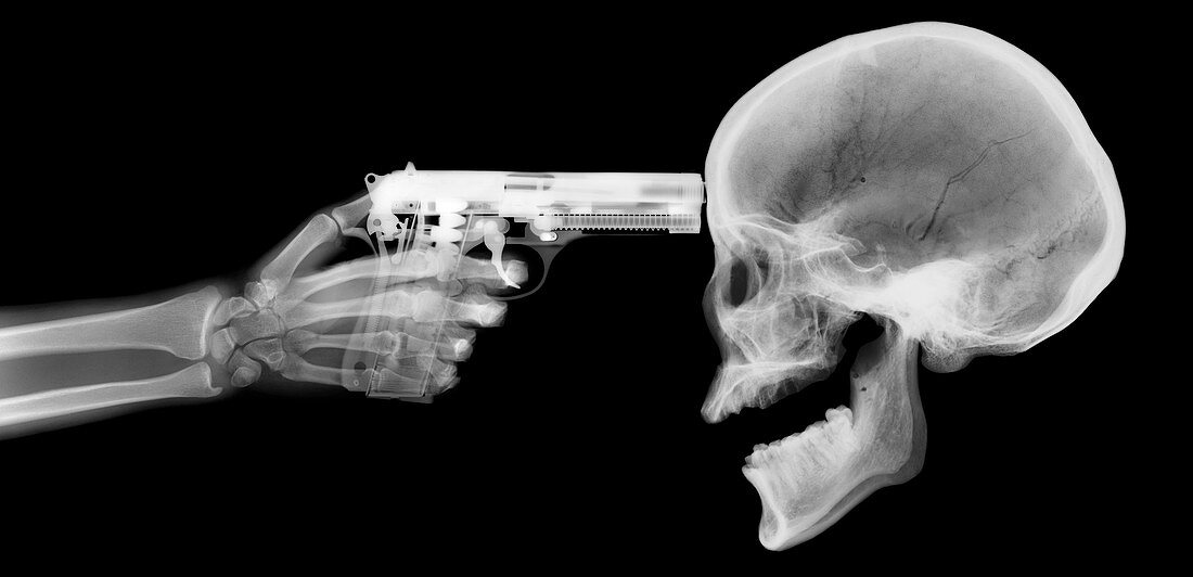 Gun and skeleton, X-ray