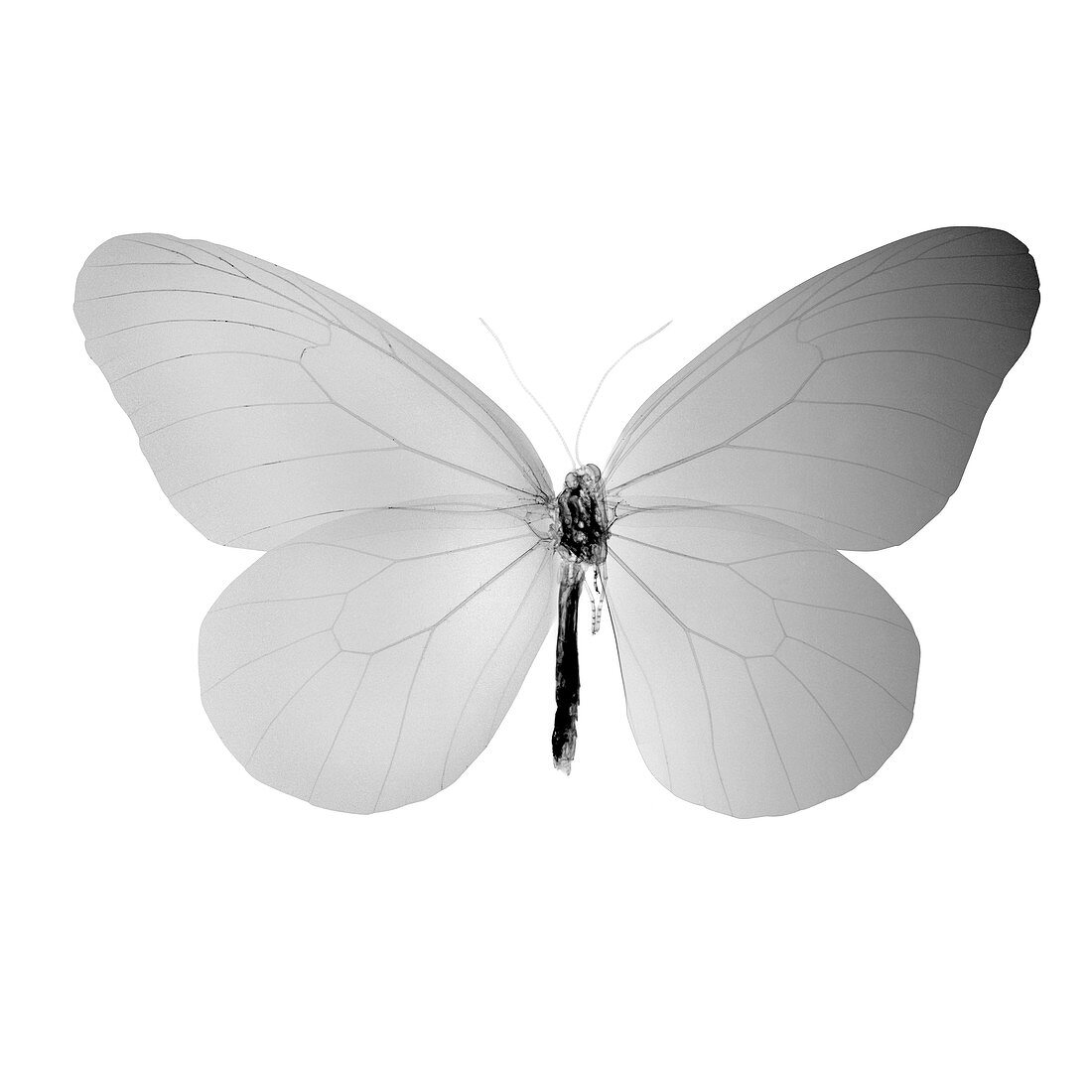 Butterfly, X-ray