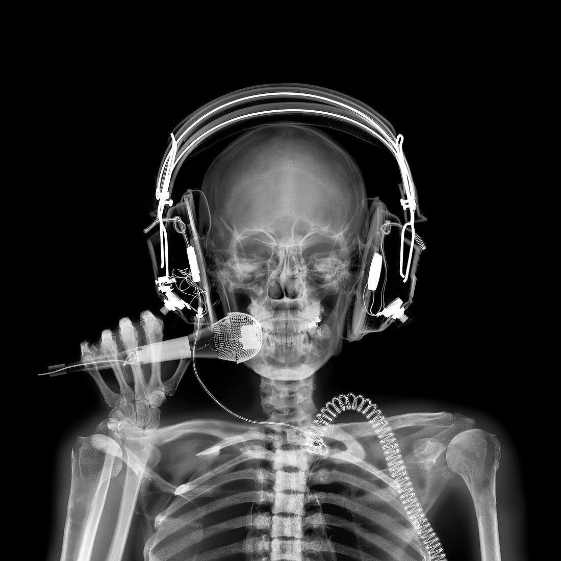 Disc jockey, X-ray