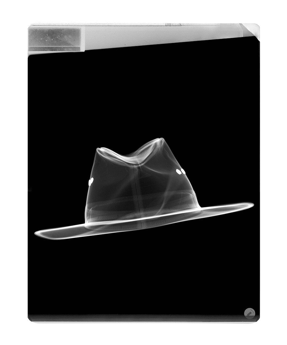 Fedora hat, X-ray