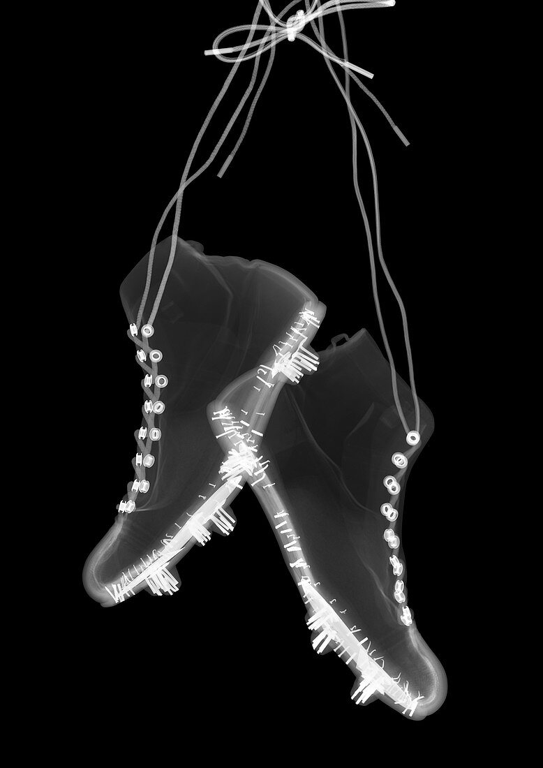 Football boots, X-ray