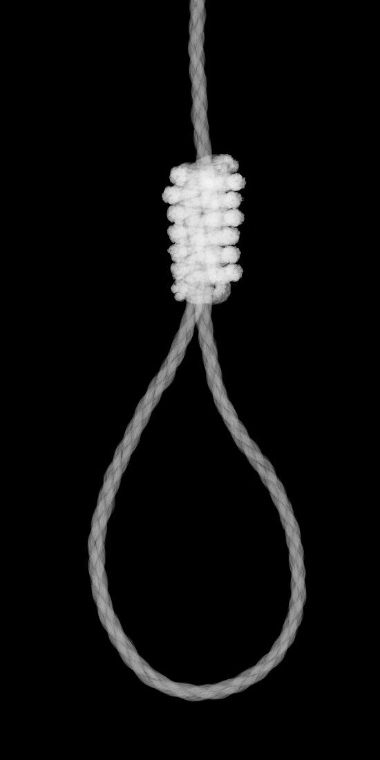 Rope hanging noose, X-ray