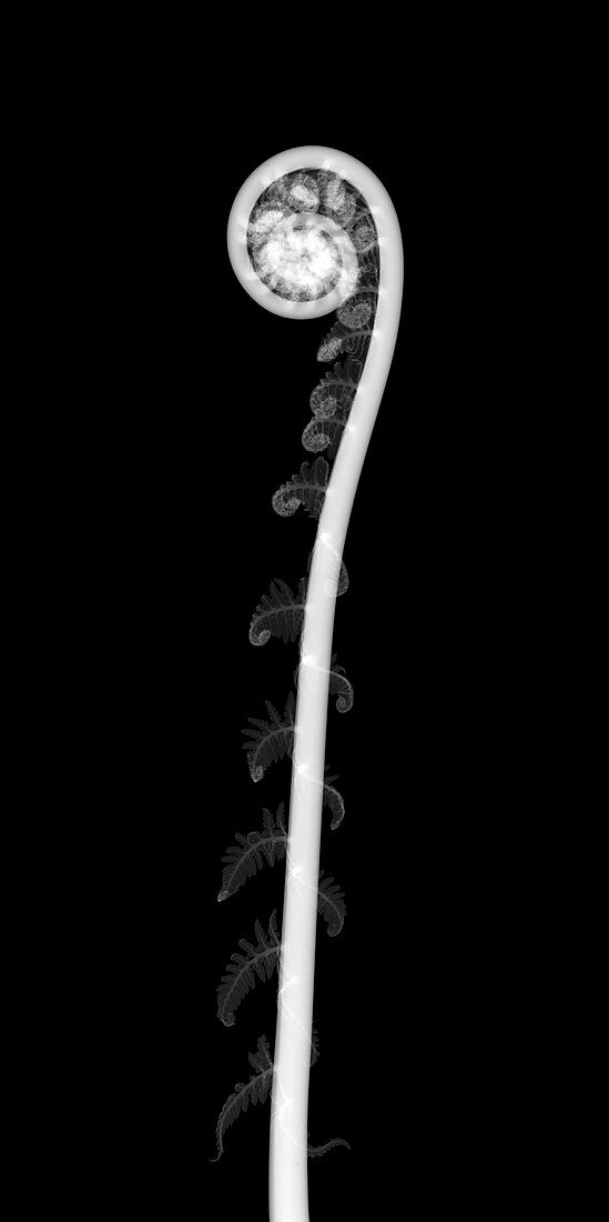 Tree fern (Dicksonia sp.), X-ray