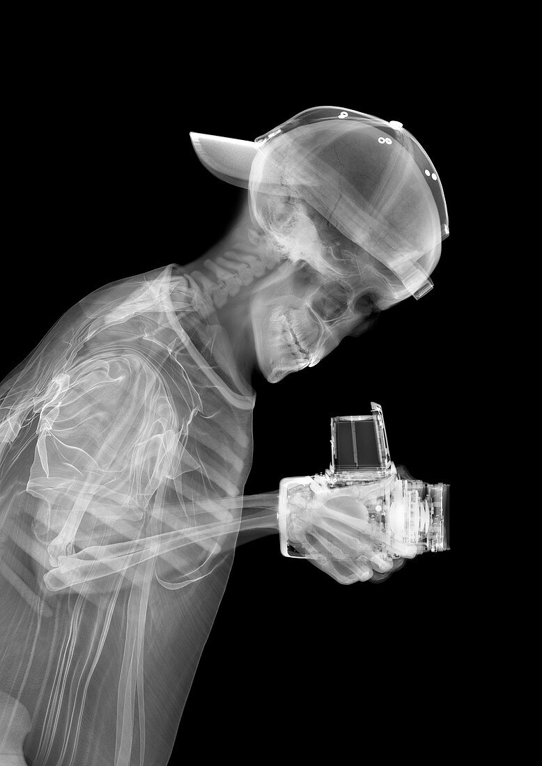 Skeleton photographer, X-ray