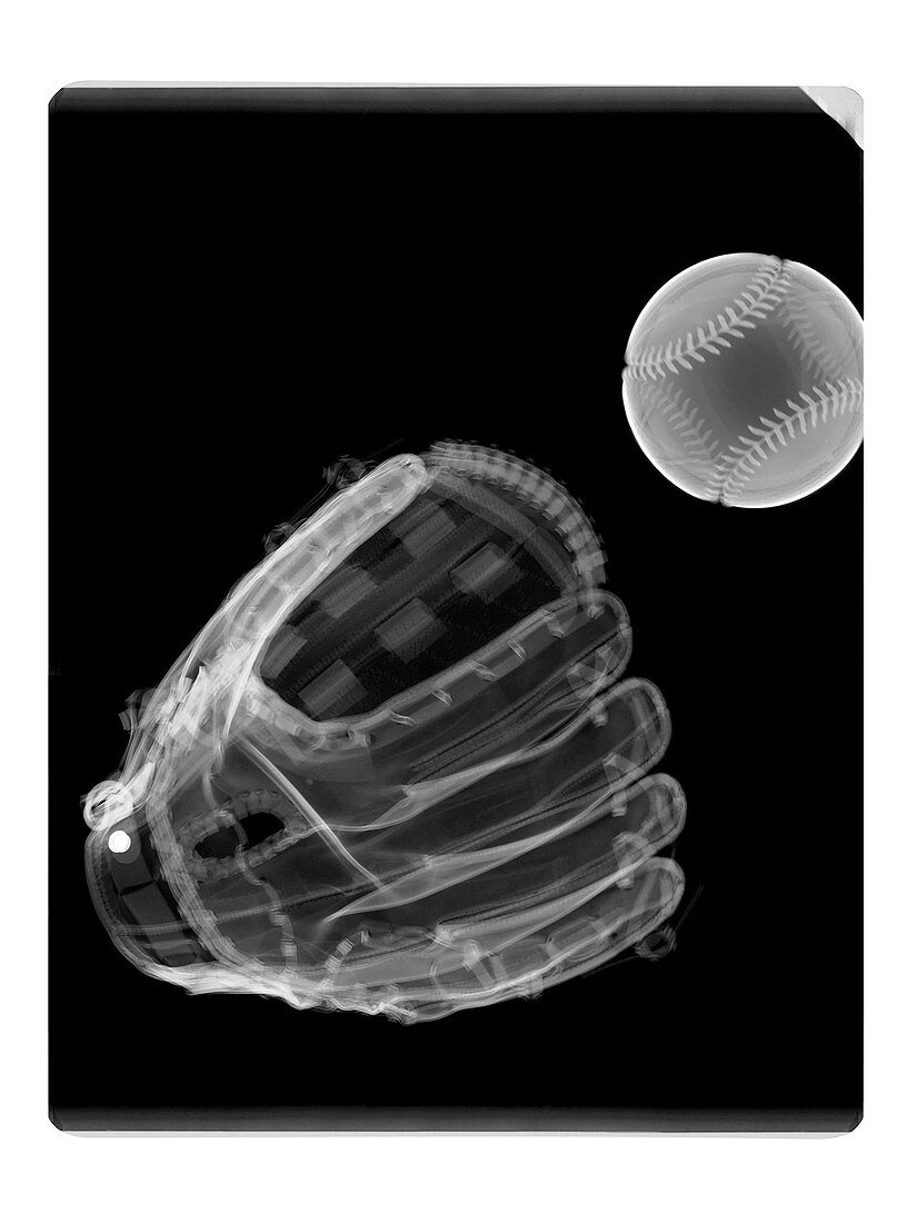 Baseball and glove, X-ray