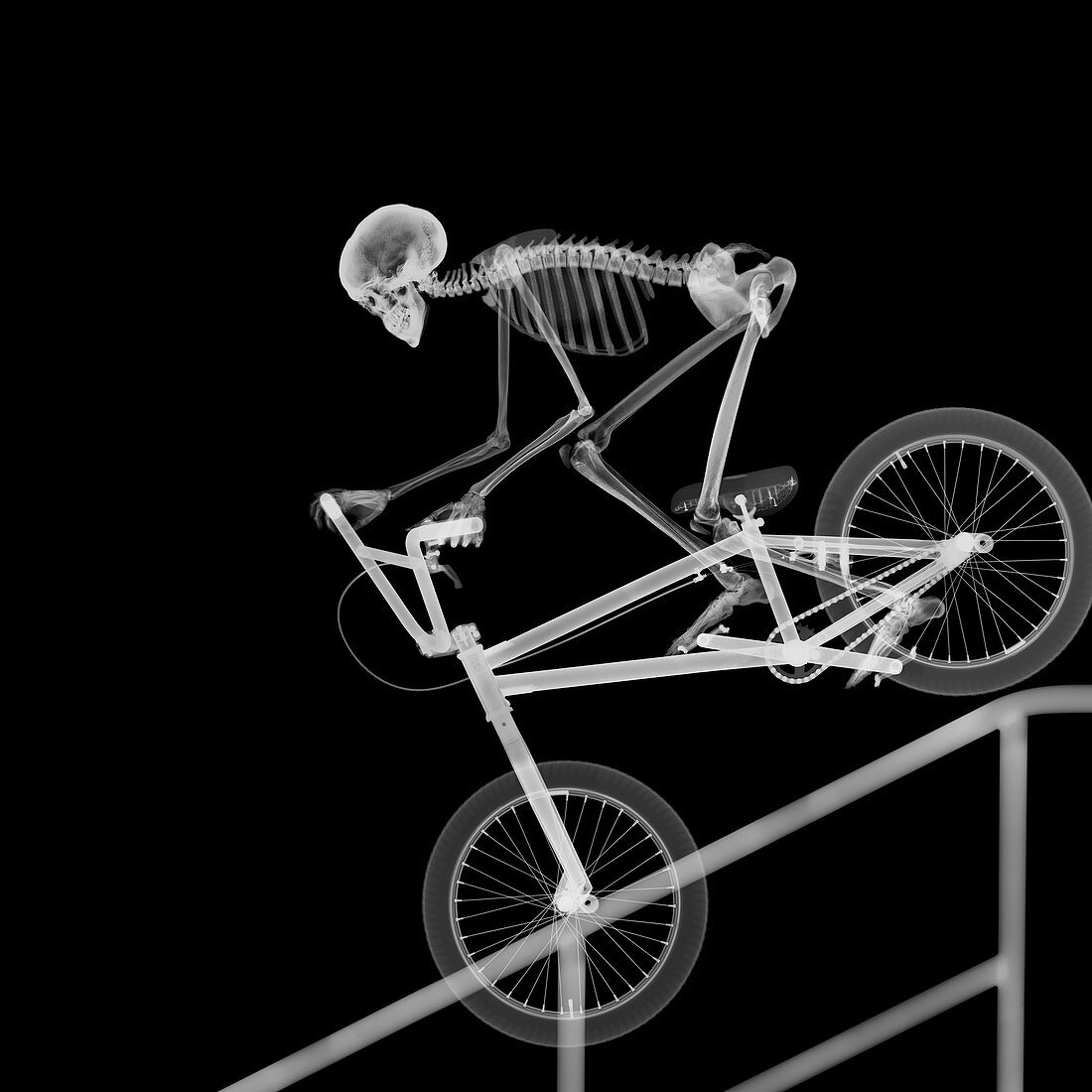 Skeleton bike stunt, X-ray