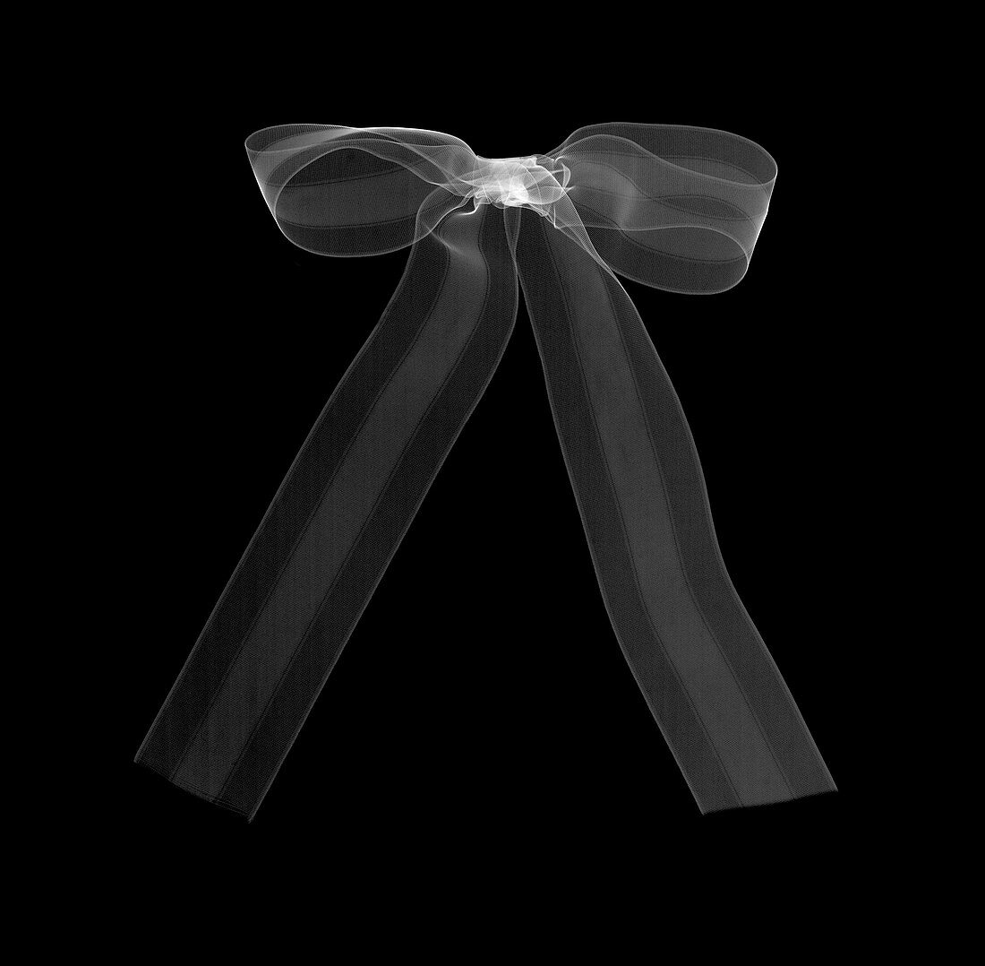Ribbon bow, X-ray