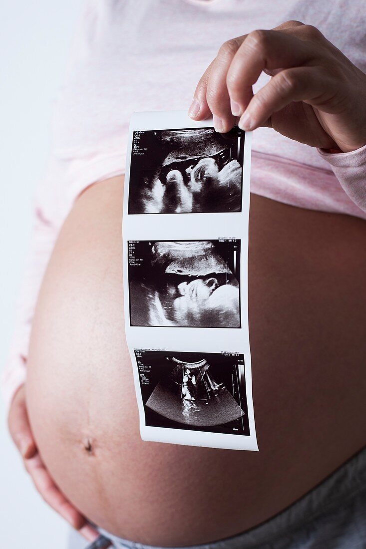 Pregnant woman holding baby scans