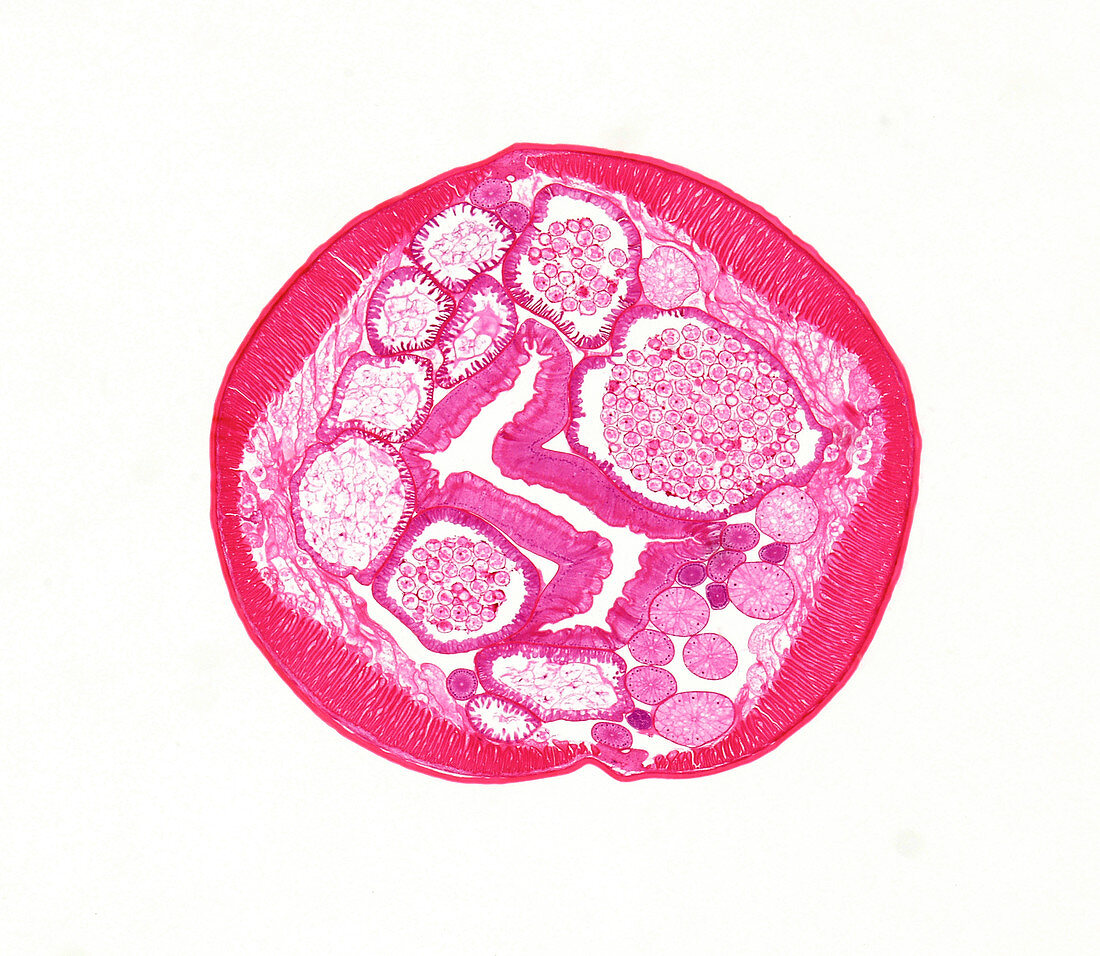 Giant roundworm male, light micrograph