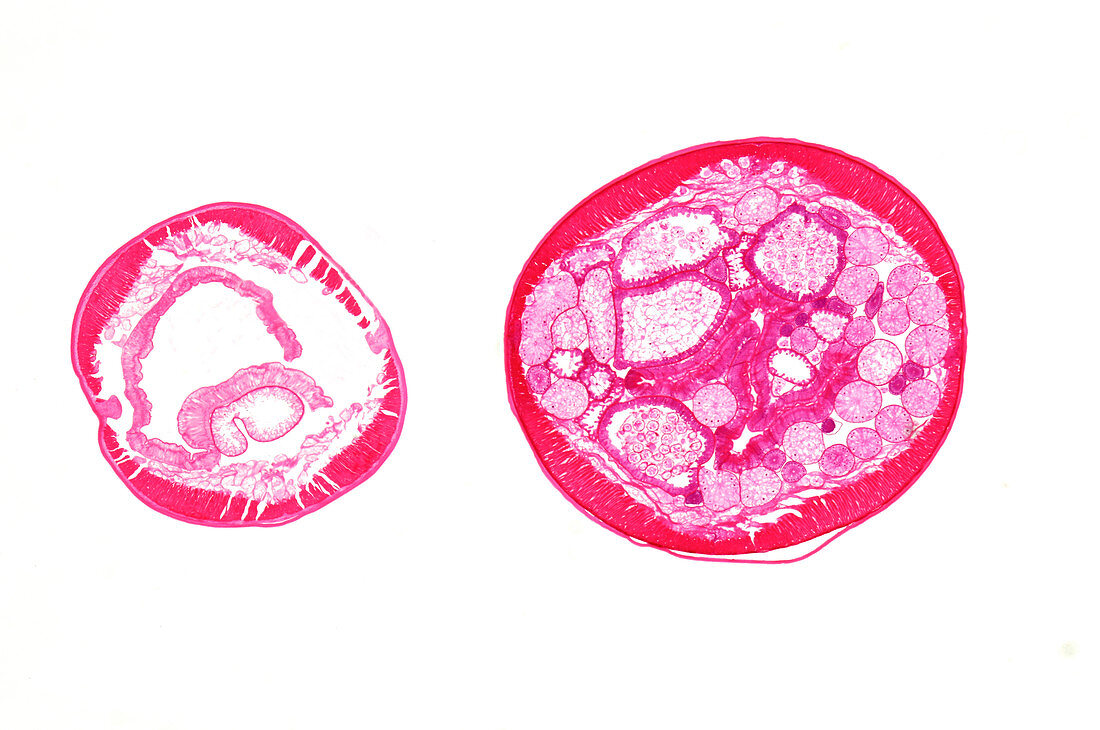 Giant roundworm female and males, light micrograph