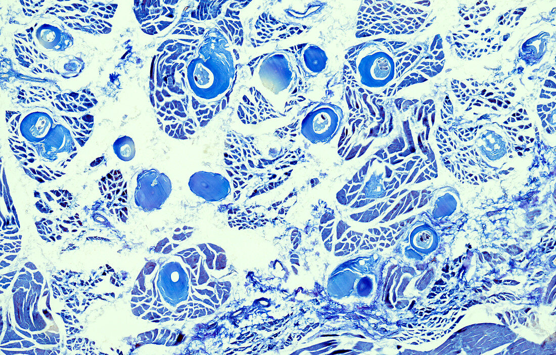 Trichinella parasite in polar bear muscle, light micrograph